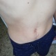 nick