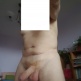 nick